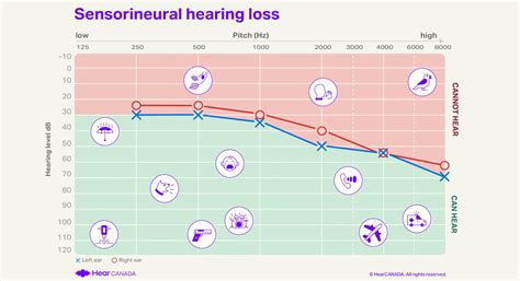 auditgram|Audiograms: What they are, how to interpret them, and more.